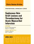 Saphenous Vein Graft Lesions and Thrombectomy for Acute Myocardial Infarction, An Issue of Interventional Cardiology Clinics, E-Book